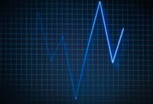 digital call pattern analysis